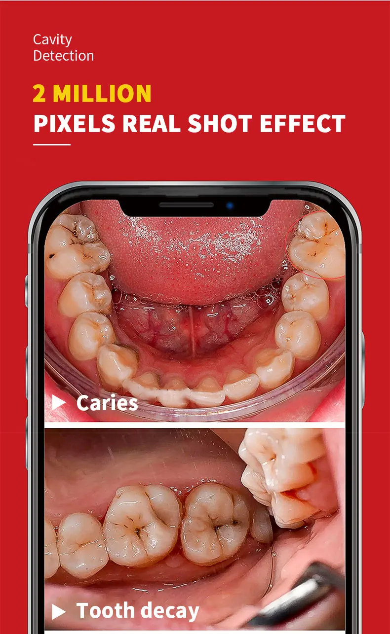 Vídeo para Ios Inspeção de Dentes sem Fio wi Endoscópio Dental Oral Ajustável Luzes Led Câmera Intraoral hd Android fi 8 10 8 ajustável luzes led câmera intraoral hd
