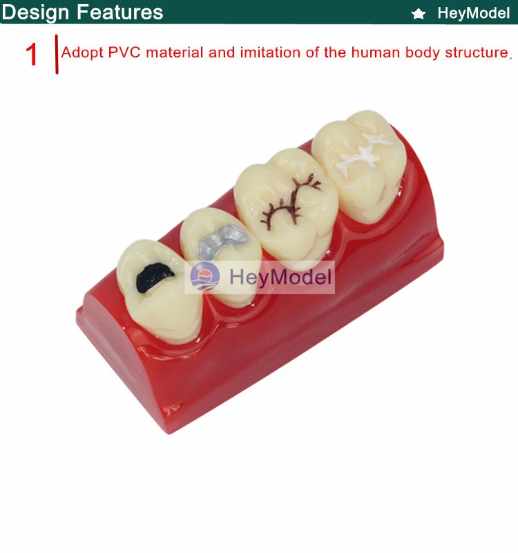 Heymodel зубы ямы и трещины Модель Стоматологическая dentition модель