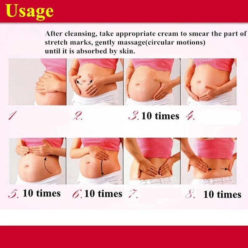 AFY без боковых эффектов беременность ремонт крем стрейч марка для удаления материнства снять частицы жира уход за кожей