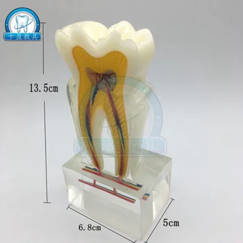

dental teaching equipment 6X enlarge dental anatomy tooth model Crystal tooth structure analysis