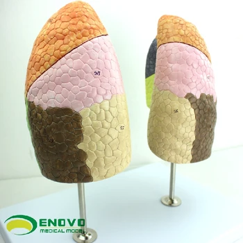 

Anatomical model pulmonary segmental thoracic surgery respiratory system