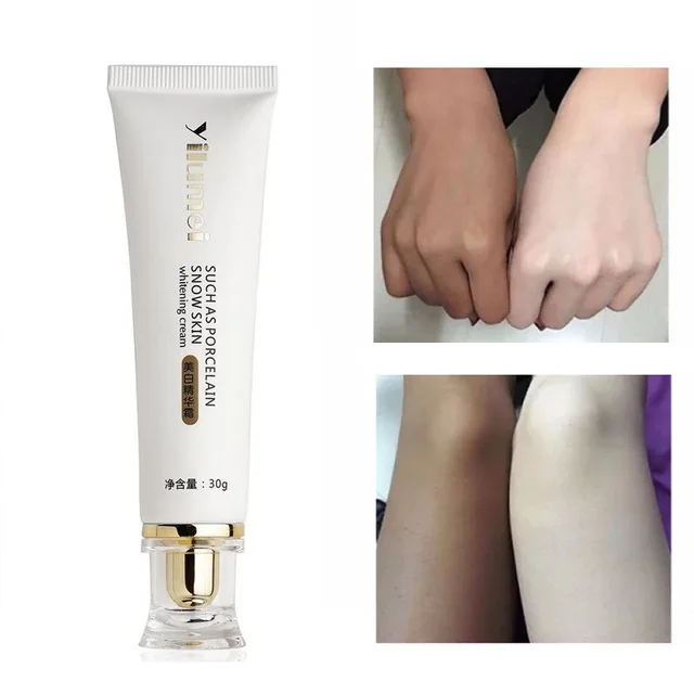 Whitening Skin Bleaching Cream Whole Body Lotion Legs Knees Private