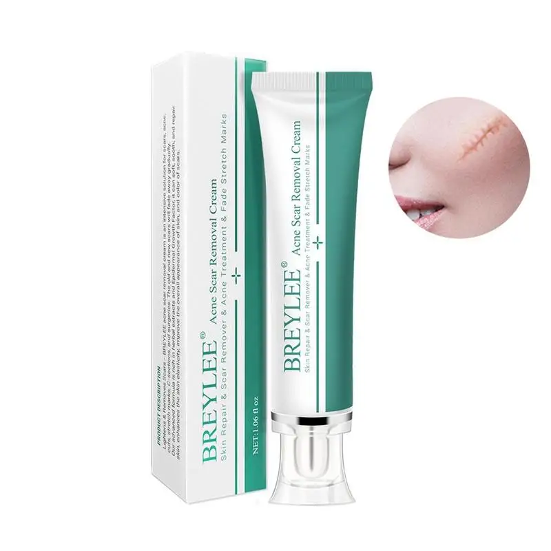 

BREYLEE Acne Scar Removal Cream Face Cream Skin Repair Skin Care Scar Acne Treatment Remove Stretch Marks Whitening Cream 30g