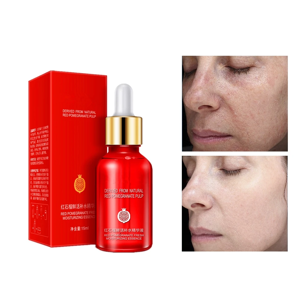 ). Baby massage oil 100 ml/bottle. база+топ+укрепление 11мл bio nail. смесь для железнения бетона.