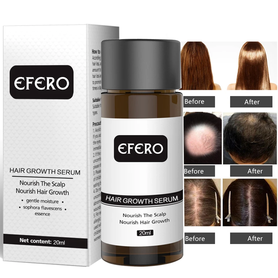 Efero мощная Сыворотка для роста волос, предотвращающая выпадение волос, эфирное масло, удлиненное, более плотное, предотвращающее облысение, продукты для профессионального роста волос