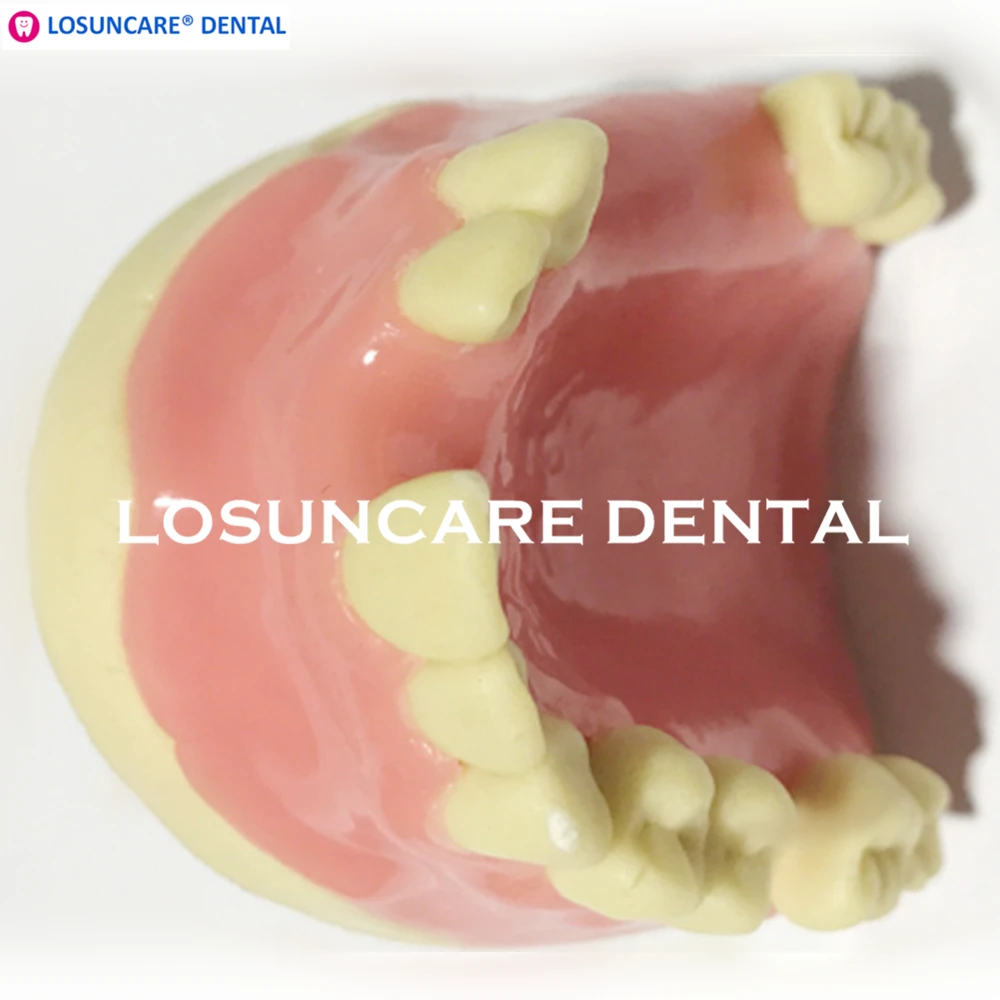 Стоматологическая модель для посадки зубов, модель имплантата нижней челюсти с мягкой десной для медицинского стоматологического образования