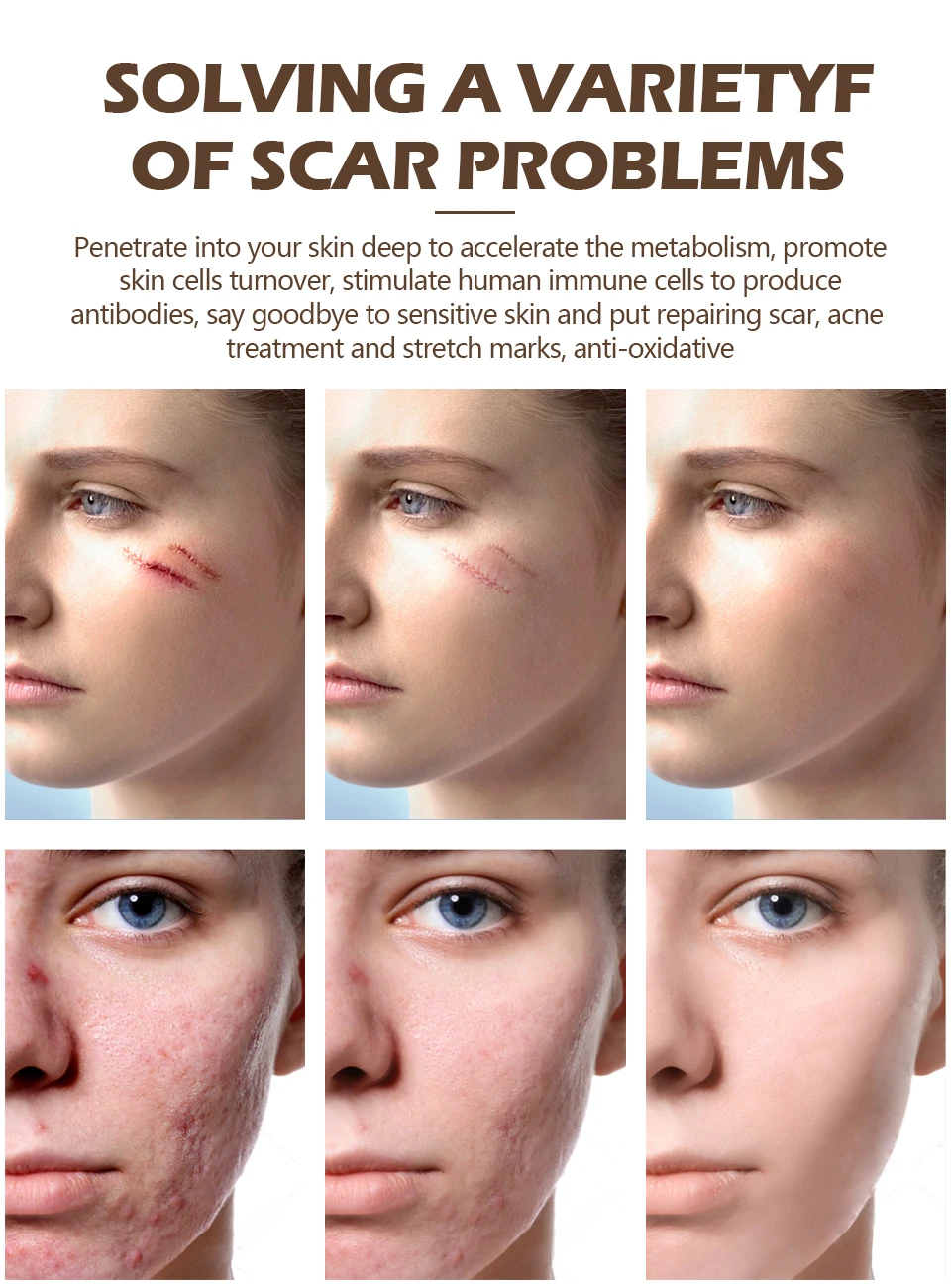Vibrant Glamour Crocodile Dispel Scar Repair Face Gel Remove Acne Scar Stretch Marks Treatment Skin Lightening Whitening Care Serum Aliexpress