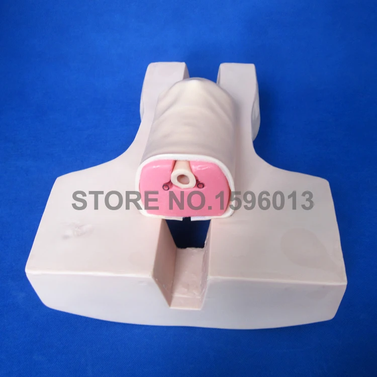 58 Tracheostomy (5)