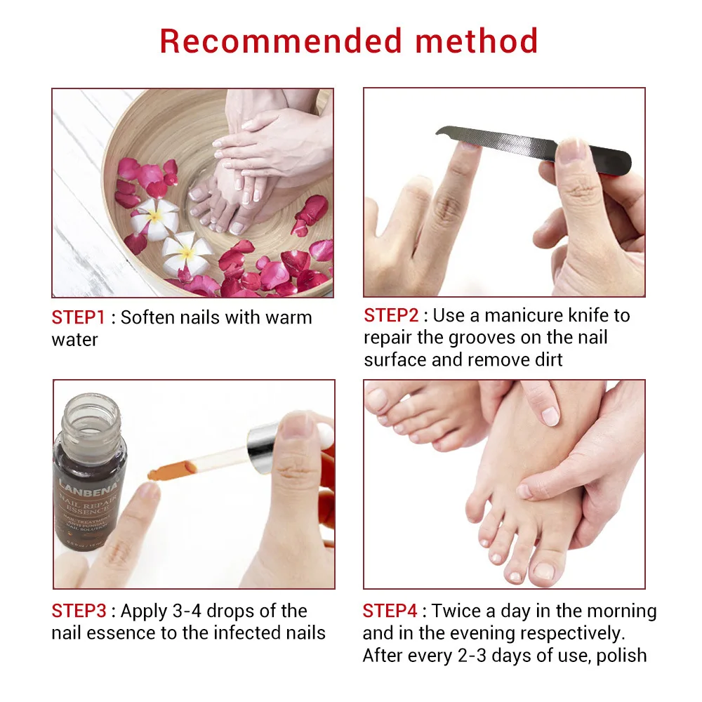 LANBENA средство для восстановления ногтей, сыворотка, лечение грибков, удаление онихомикоза, ноготь, питательное осветление, уход за руками и ногами