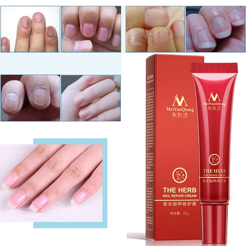Creme de Pele para Estrias Remoção da Cicatriz para Reparação da Pele Dropshipping Suave Maternidade Creme Corporal Remover Cicatriz Pós-parto 10 Pçs 16 da pele maternidade creme corporal remover cicatriz pós-parto