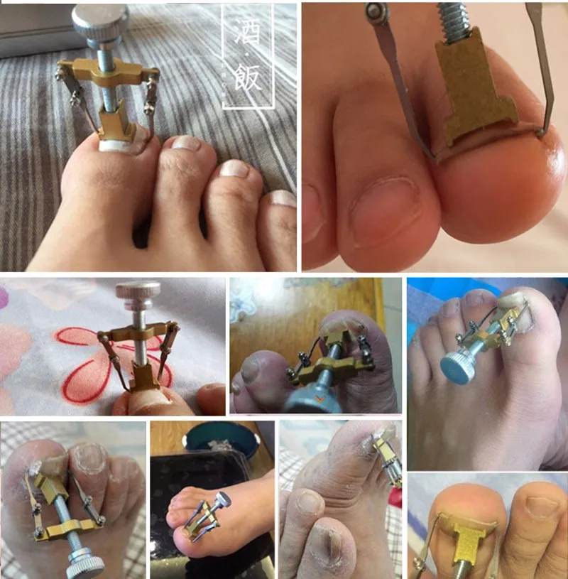 HTB1gpGXKXXXXXatXpXXq6xXFXXXA