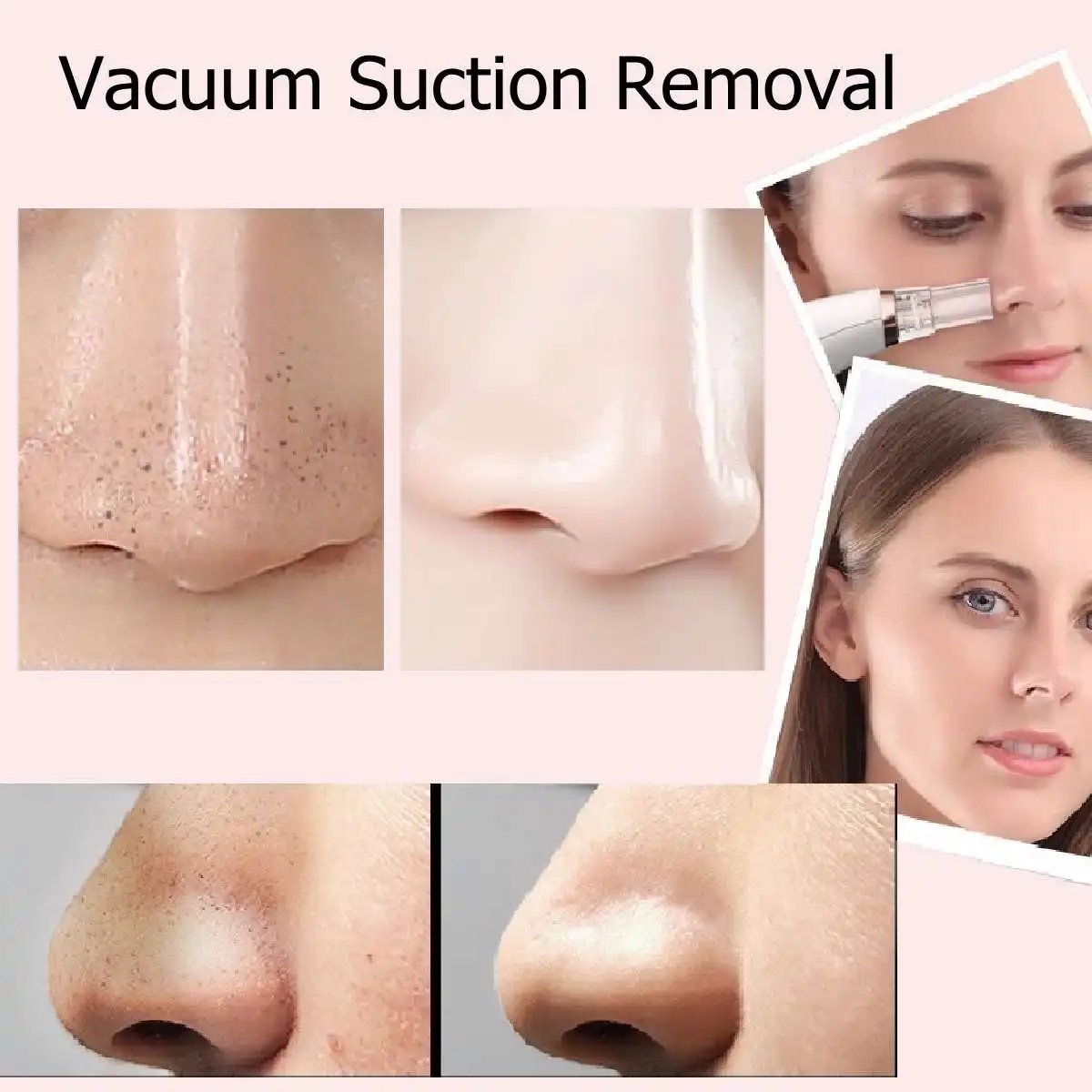 Черная точка вакуумной usb зарядки Blackhead машина для чистки лица для женщин