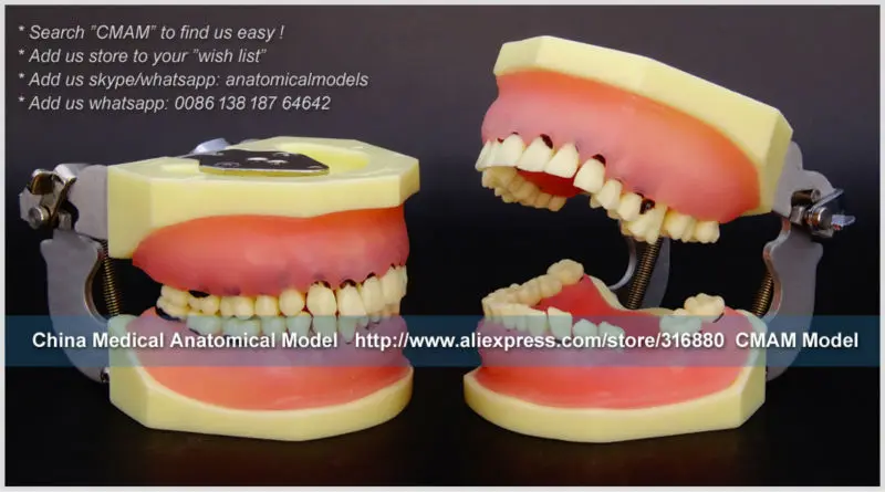 22304 Severe Periodontal Disease Jaw Model for Periodontal Surgery 1