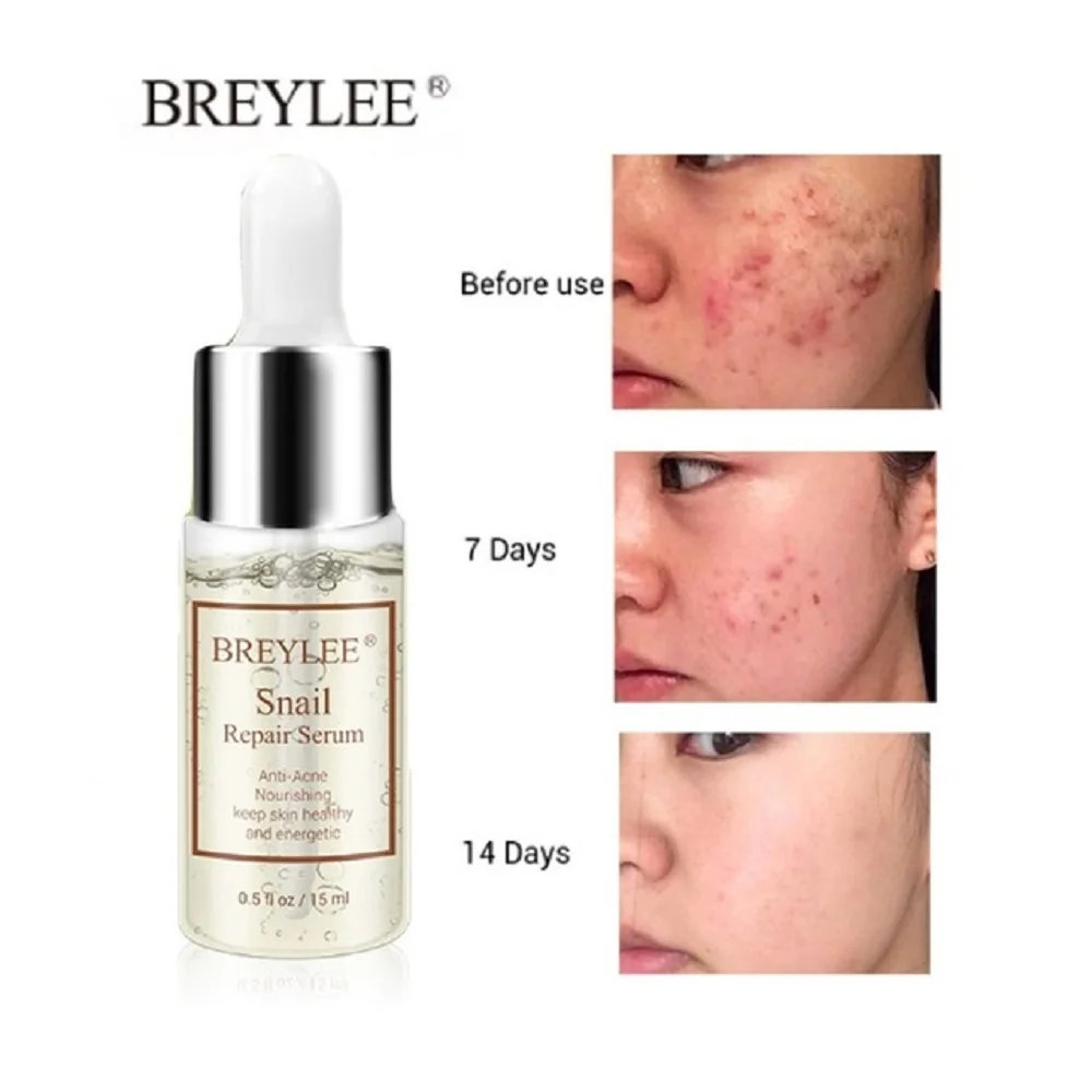 Сыворотка Для Лица Против Акне Beauty Купить