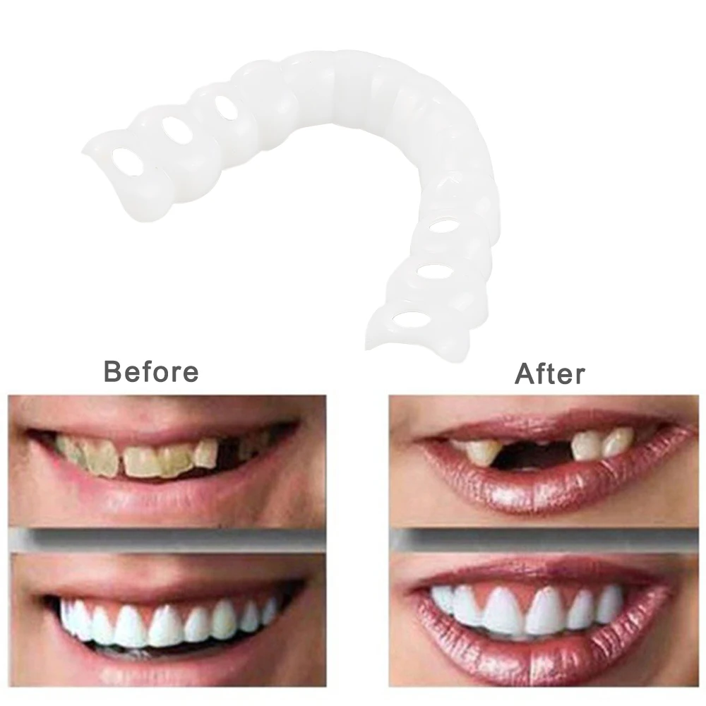 

2Pcs Upper+Lower False Teeth Veneers with Box Perfect Smile Natural Cosmetic Fake Tooth Cover For Oral Care Drop Shipping
