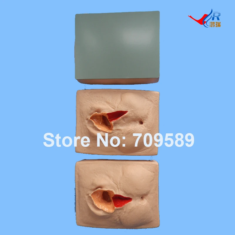 Горячая ISO Vivid Vulva Suturing тренировочная модель, 3 набора, epsiorrhaphy тренажер