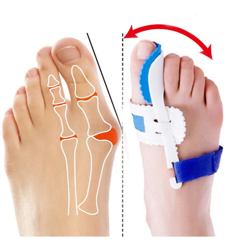 1Pair Bunion Corrector Hallux Valgus Splint Pedicure Tools Orthopedic Straightener Toe Separator Foot Correctors Feet Care Tools 1Pair Bunion Corrector Hallux Valgus Splint Pedicure Tools Orthopedic Straightener Toe Separator Foot Correctors Feet Care Tools