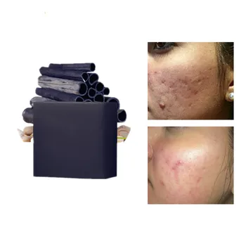 

Herbal Facial Soap Moisturizing Whitening Filling Water Anti Wrinkle Lift Firming Esseence Skin Care Fade Spots And Freckles