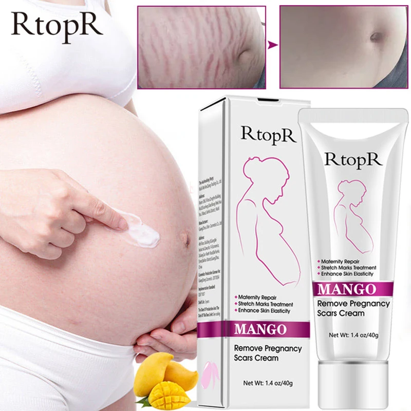 

Mango Remove Pregnancy Scars Acne Cream Stretch Marks Treatment Maternity Repair Anti-Aging Anti Winkles Firming Body Creams