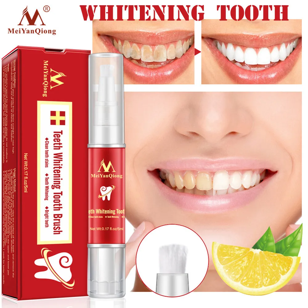 

Teeth Whitening Gel Pen Quick Remove Stain Yellow Tooth Brightening White Pen Perfect Smile Veneers Blanchiment Dentaire#