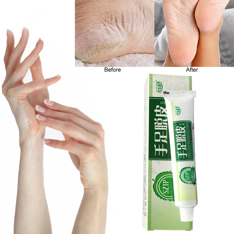 3 Pcs / Lot Horse Oil Feet Cream Beriberi Cream Athlete Hand Foot Feet