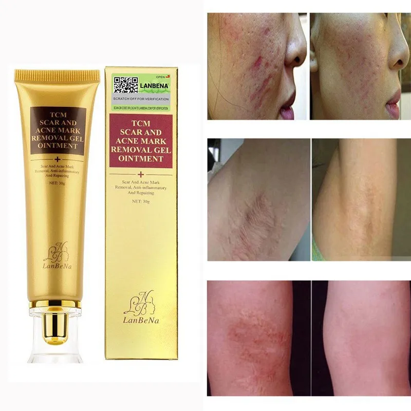 

30g Acne Scar Removal Cream SCAR ACNE MARK REMOVAL GELProfession Moisturizing