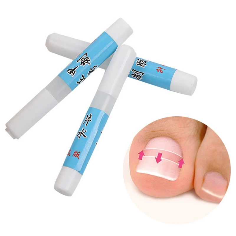 

KLV 3g Nail Glue Ingrown Toe Nail Correction Pedicure Patch Adhesive Foot Care Kit