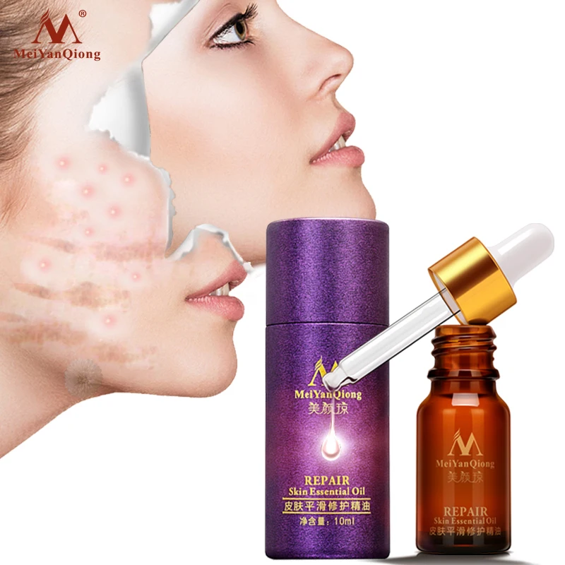 

Makeup Skin Care Smooth Acne Trauma Scar Repair Liquid Serum Oil-control Moisturizing Lavender Skin Repair Essential Oil 10ml