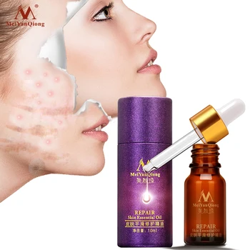 

Makeup Skin Care Smooth Acne Trauma Scar Repair Liquid Serum Oil-control Moisturizing Lavender Skin Repair Essential Oil 10ml