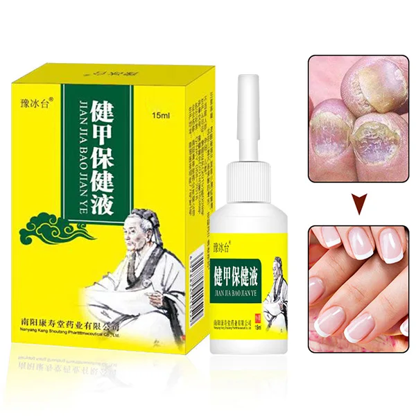 High Quality 15ml Nail Fungal Treatment Onychomycosis Removal Anti Fungus Nails Care Repair Liquid