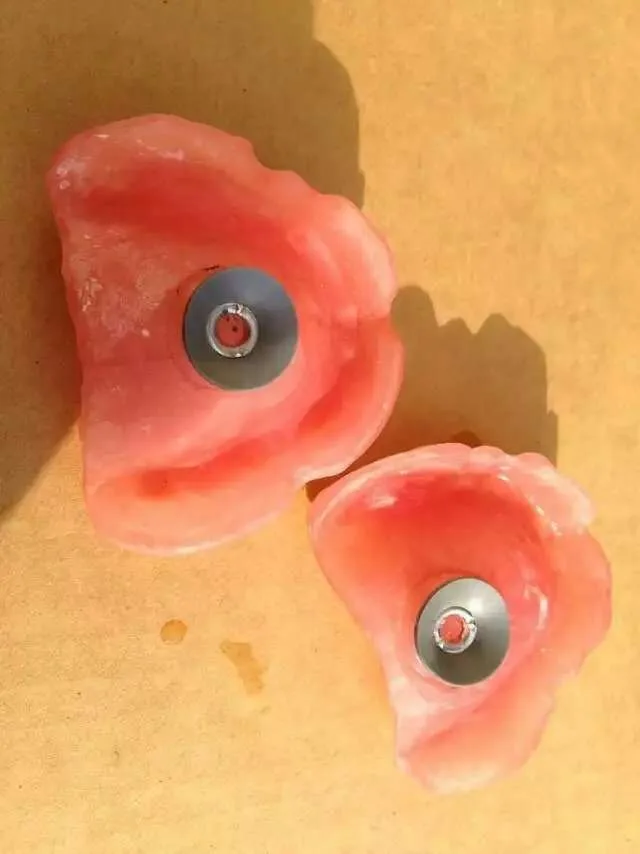 plate partial dental denture upper acrylic retention materials teeth sucker