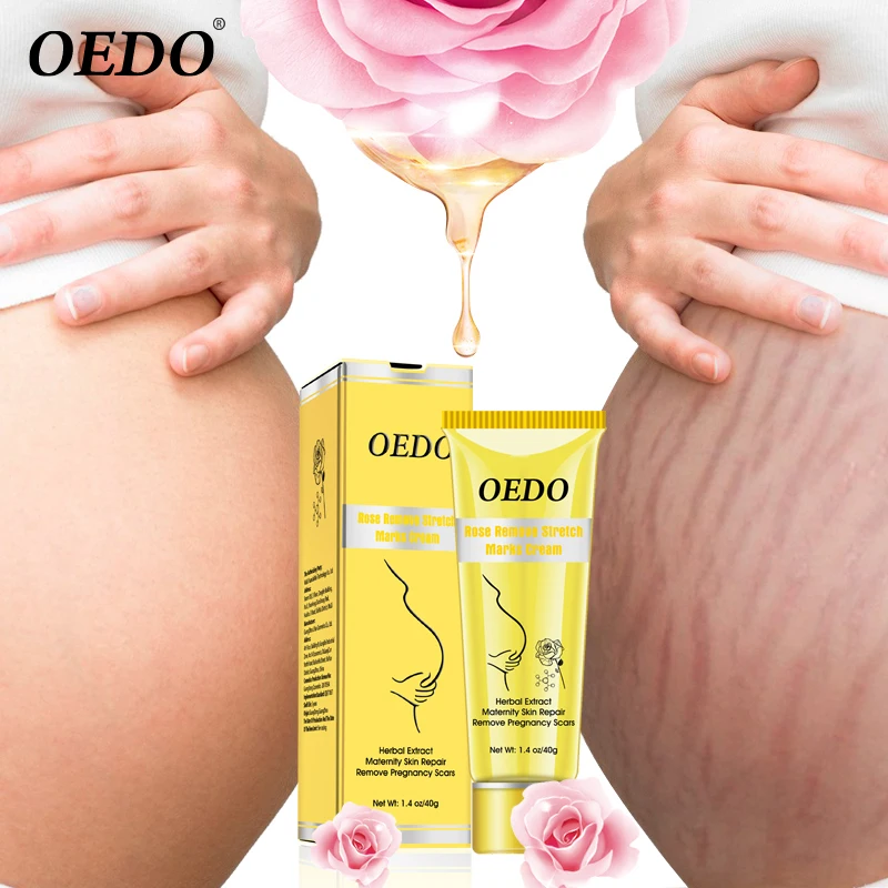 Крем Для Удаления растяжек OEDO Rose антивозрастной Восстанавливающий уход за кожей