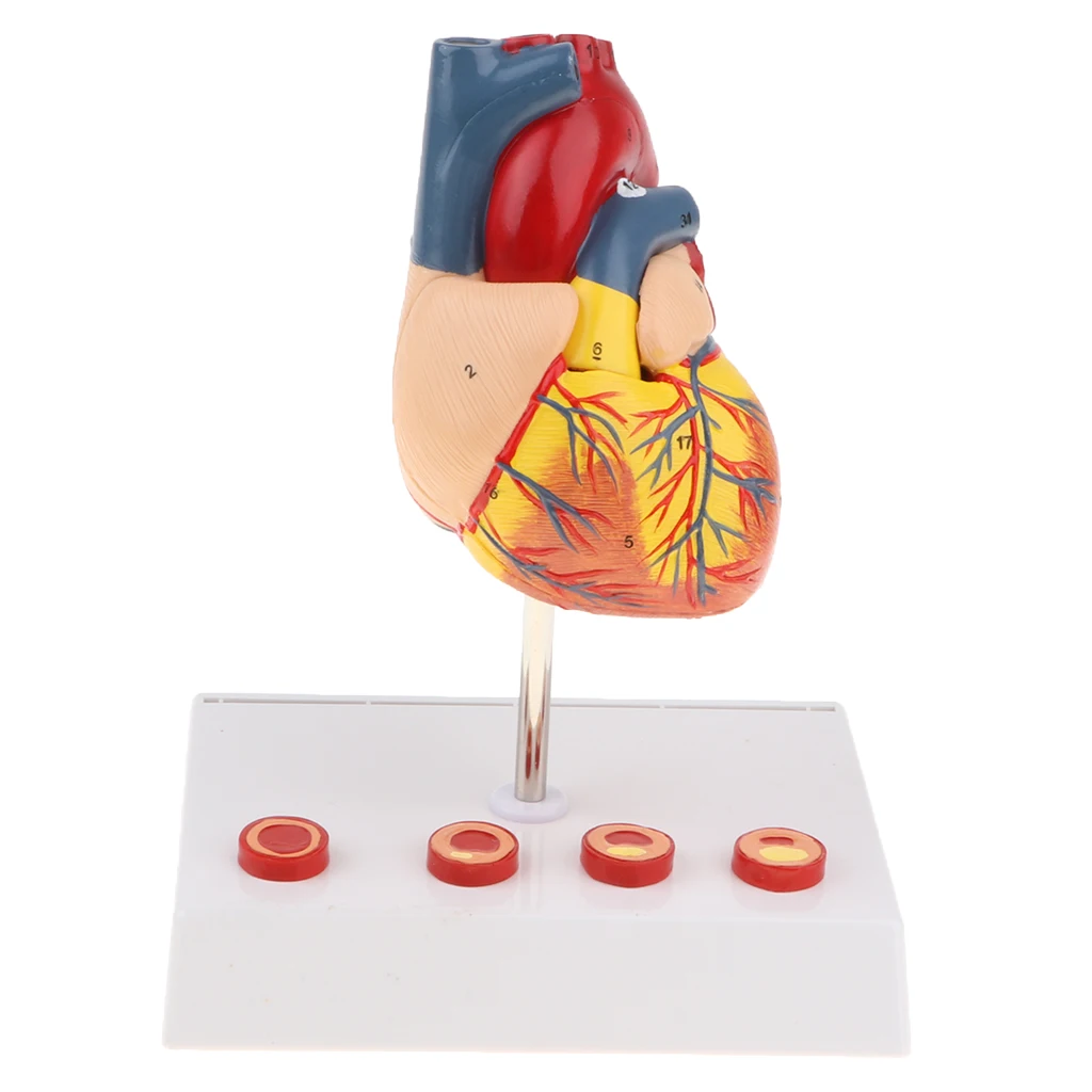 

1:1 Lifesize Human Heart Vein & Artery Structure 4-stage Thrombus Model School Learning Tool Lab/Medical Equipment