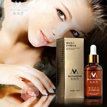 1 шт. травяное Лечение ногтей эфирное масло для рук и ног отбеливание пальцев ног удаление грибка ногтей инфекция Уход за ногами лак для ногтей GelTSLM2