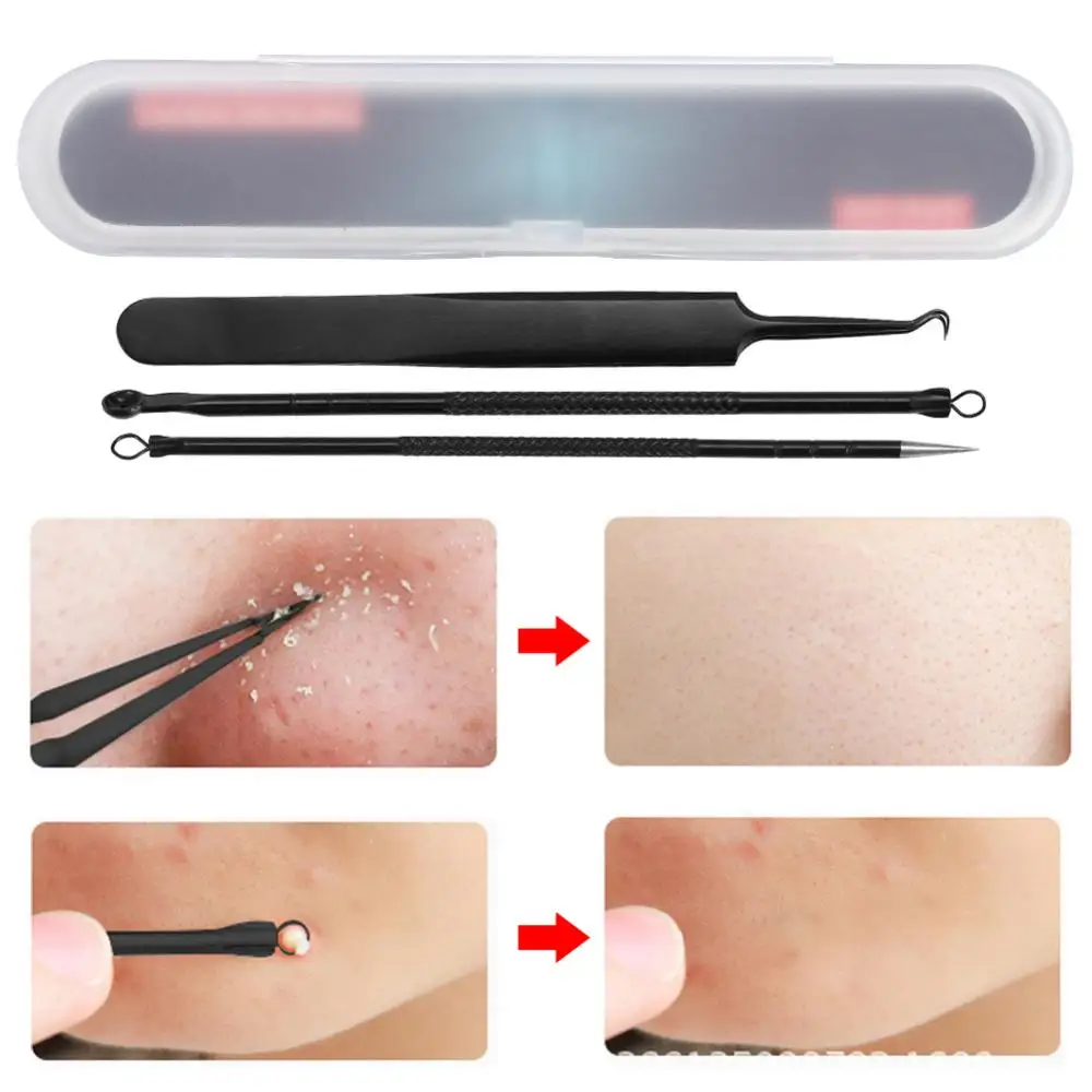 

3Pcs Acne Blackhead Needles Kits Facial Pore Cleaner Acne Tweezer Remover Pimple Extractor Acne Removal Needles Skin CareTools