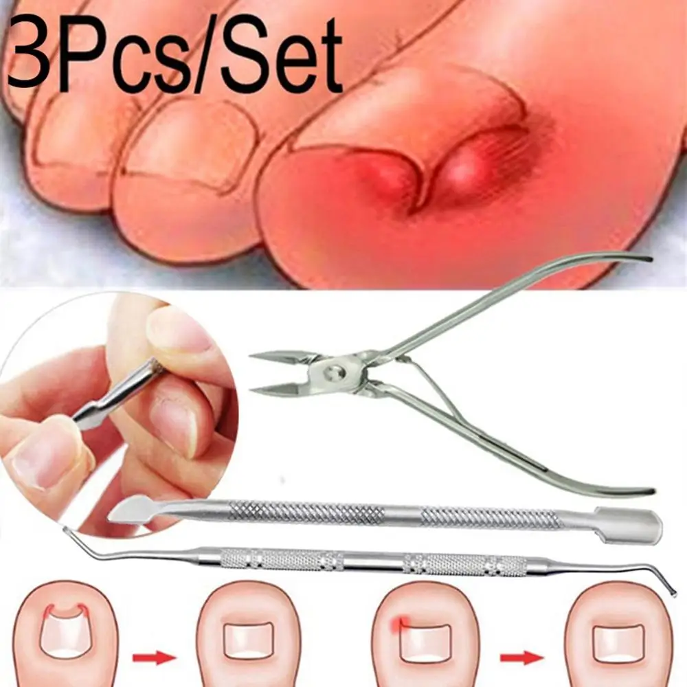 

New 3Pcs/1Set Ingrown Toe Nail Correction Nippers Clipper Cutters Dead Skin Dirt Remover+Paronychia Podiatry Pedicure Care Tool