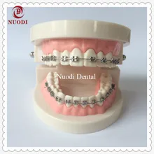 Стоматологический ортодонтический зубы модель с кронштейном/Стоматологическая Орто металлическая модель брекетов/стоматологическая лаборатория образования Ортодонтические зубные модели
