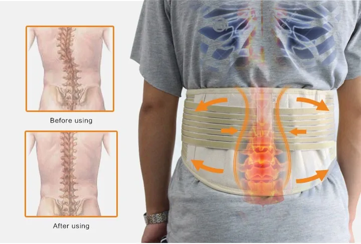 Tcare Регулируемая САМОНАГРЕВАЮЩАЯСЯ турмалиновая бандажная поддержка талии тренажер магнитотерапия поясной пояс Поясничный уход брекеты