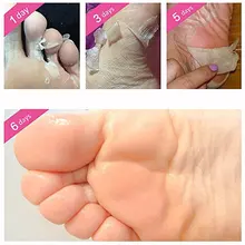 No Salicylic кислота питает отшелушиватель маска для ног пятка Уход за ногами пилинг кутикул отбеливание каллус твердый мертвый Бережный уход за кожей