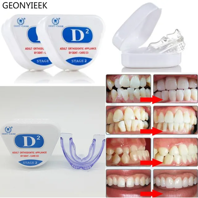 Orthodontic Braces Dental Braces Instant Smile Silicone Teeth Alignment