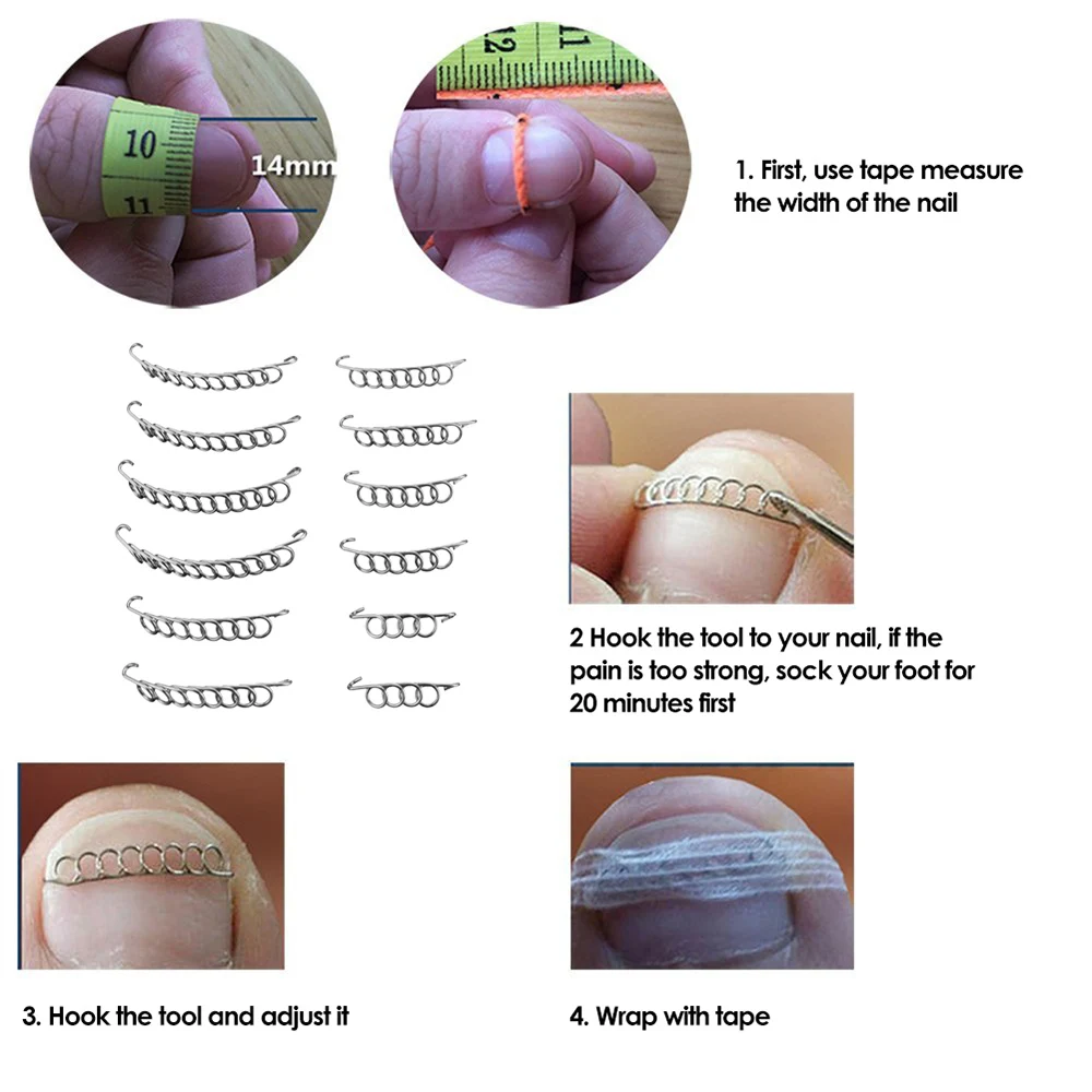 12 шт./кор. вросшие ногти для ног "францзуский маникюр" коррекции фиксаж провода 6 размеров вросшие ногти носок корректор для педикюра лечебный инструмент для ухода за ногами
