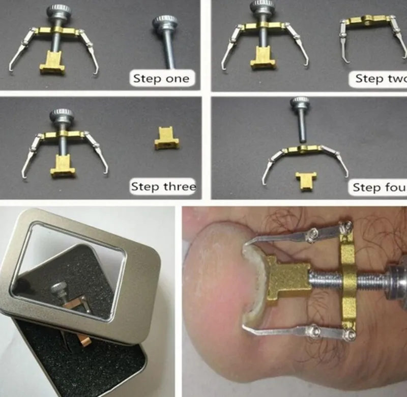 Инструмент для ухода за ногами Ingrown коррекция ногтей носочки кусачки для стрижки кусачки для удаления грязи из мертвой кожи+ Paronychia Podiatry педикюр