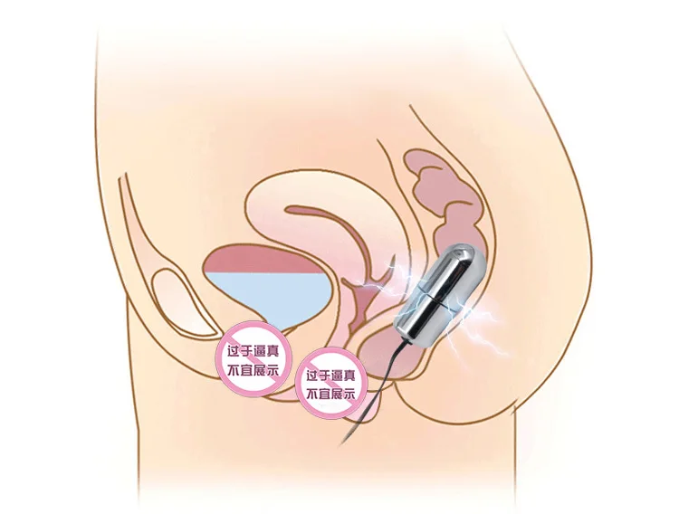 9228993169_1729638311