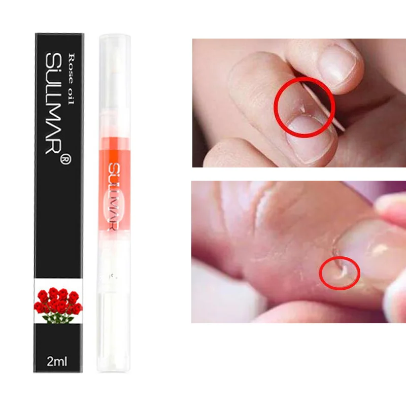 Китайская травяная мазь для лечения грибка ногтей|fungus treatment|nail fungus treatmentnail treatment |