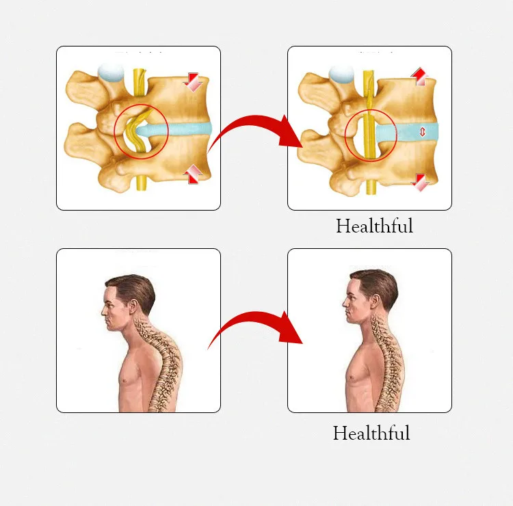 Облегчение боли в позвоночнике поясничное тяговое устройство для растяжения поясницы позвоночника Расслабление спины Массажная доска Предотвращение поясничного диска грыжа скобка
