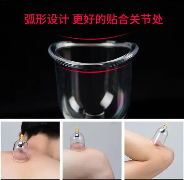 QQ20170605151001