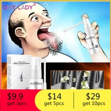 OMYLADY Уход за волосами эфирное масло для роста волос эссенция Подлинная выпадение волос Жидкая забота о теле красота густой рост волос