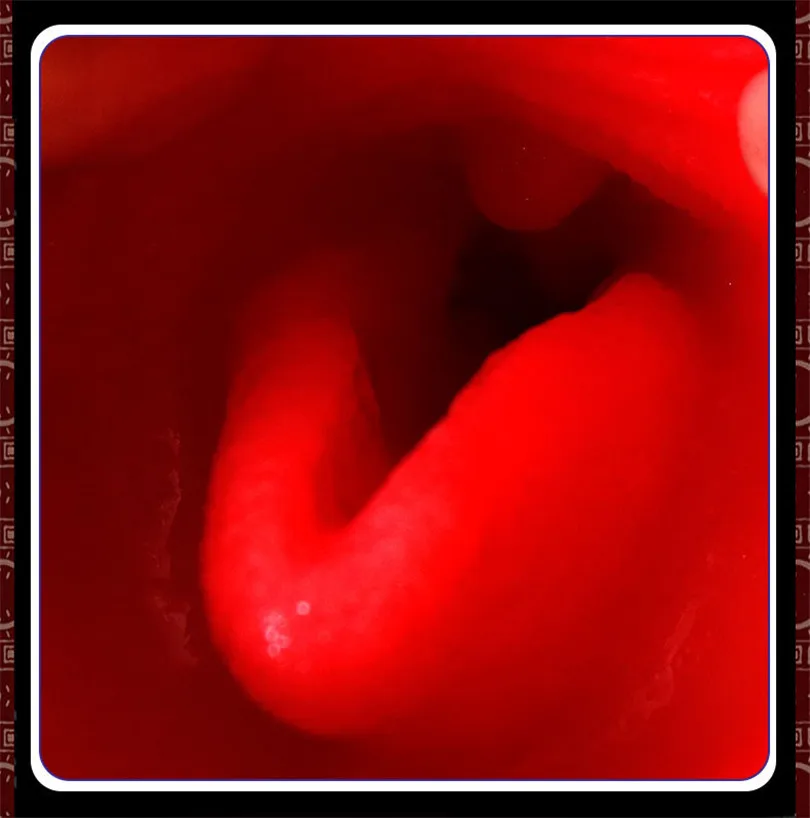 Deep Throat4