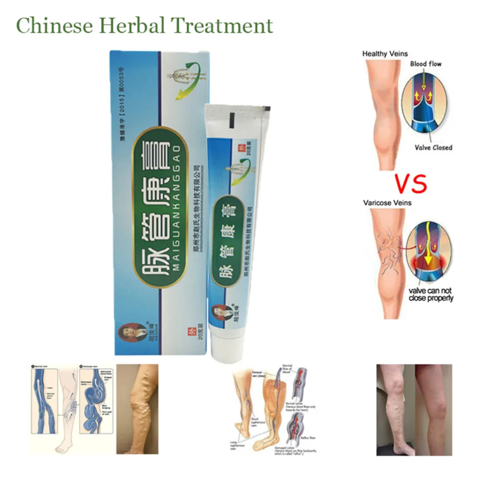1pcs 20g Chinese natural herbal medicine for treating varicose vascular