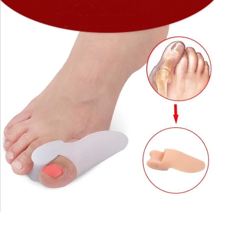 2 Stks Partij Remedical Pad Kleine Tenen Separator Set Volwassen En Kind Visco Gel Bunion Fix Teen Spacer Adult Adult Adult Setspacer Set Aliexpress